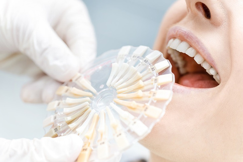 Лечение гиперестезии 1-го зуба